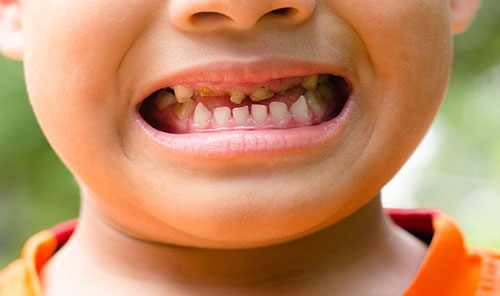 Dental hygienist at Morris Dental Care, Oldham